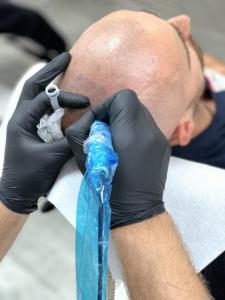 trychopigmentacja szkolenie mikropigmentacja skóry głowy